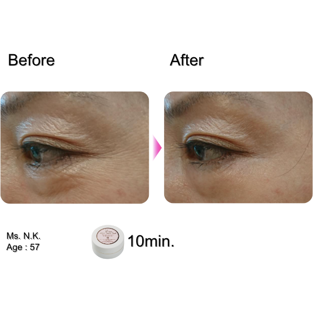 Rosy Drop Eye Patches