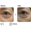 Rosy Drop Eye Patches