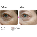 Rosy Drop Eye Patches