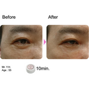 Rosy Drop Eye Patches