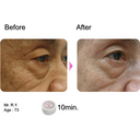 Rosy Drop Eye Patches